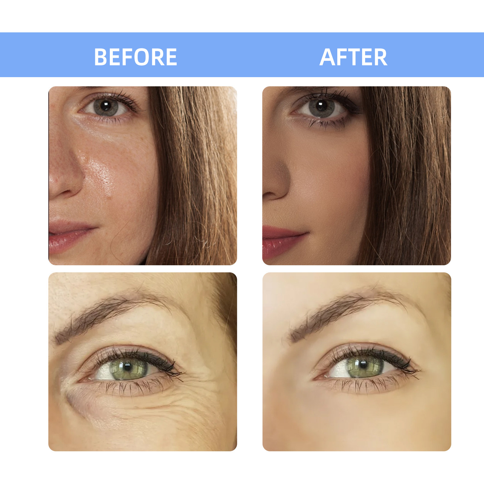 7ml*7pcs Ácido hialurónico Mes - Hyaluronic Acid Facial Serum reseña y precio