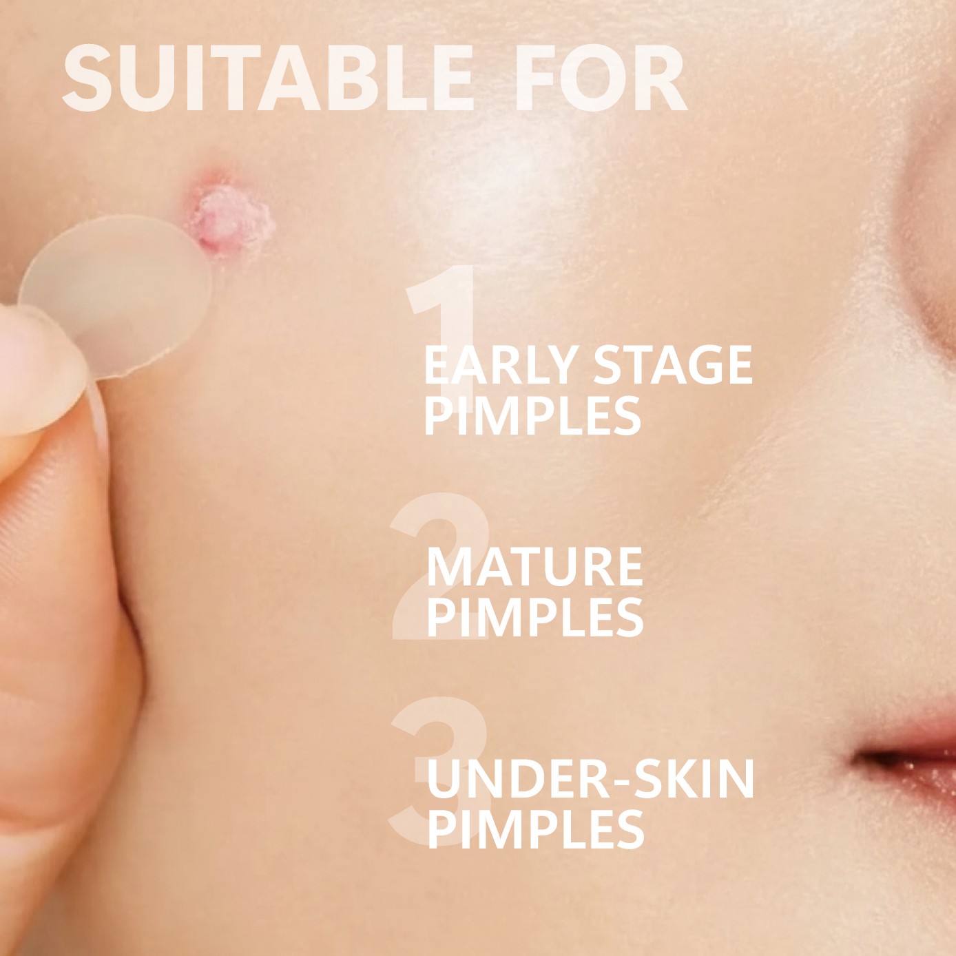Parches de microagujas para es - Hydrocolloid Pimple Patch reseña y precio