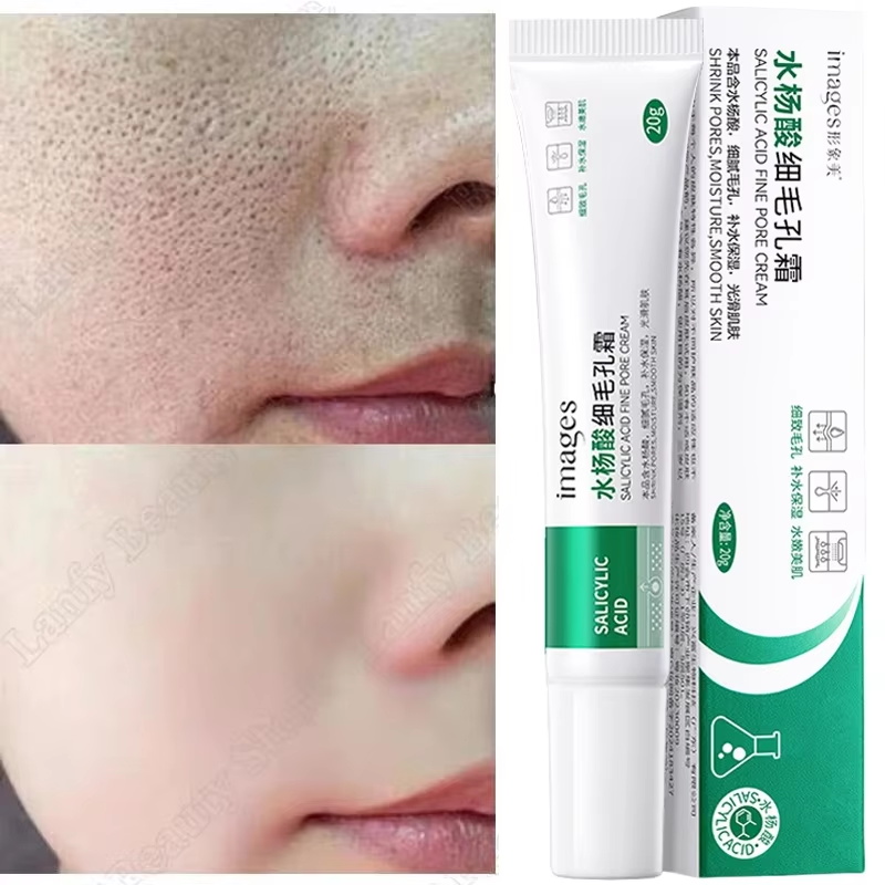 Crema Limpiadora de Poros con  - Salicylic Acid Blackhead Remover reseña y precio